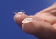 Porcelain Veneer - Size Comparison With The Contact Lens